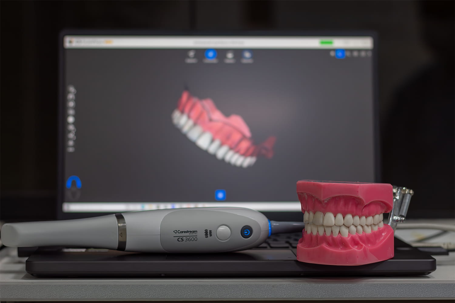 Moldes 3D de dentaduras